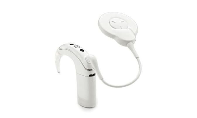 Cochlear Implant