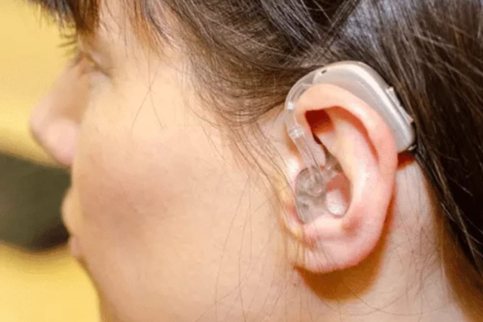 BTE (Behind The Ear)